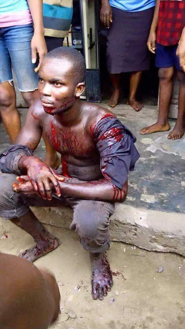 Man Allegedly Attacked By Fulani Herdsman In His Farm In Delta. Graphic Photo